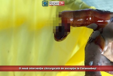 O nouă intervenţie chirurgicală de excepţie la Caransebeș! Medicii au reușit să prindă la loc un deget retezat complet