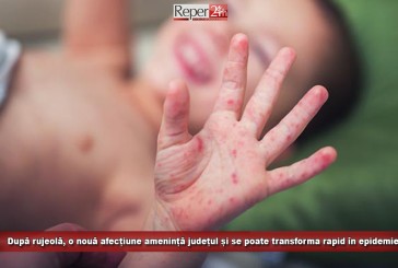 După rujeolă, o nouă afecțiune amenință județul și se poate transforma rapid în epidemie!