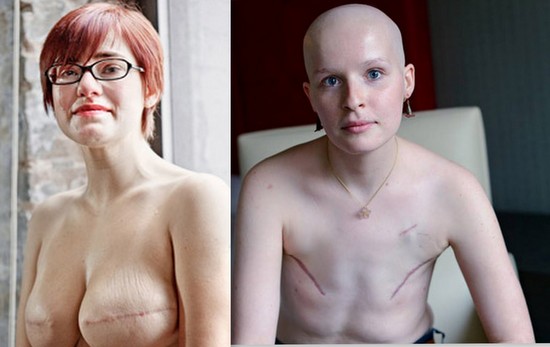 cum-arata-femeile-care-au-invins-cancerul-la-san.-imaginile-te-vor-oca